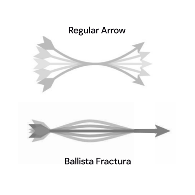 Block- - - BALLISTA Crossbows for Fishing, Hunting and Entertainment